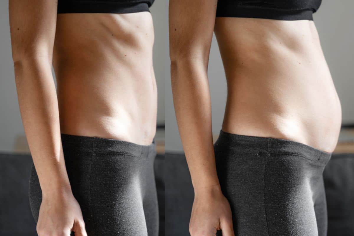 How long does diastasis recti take to improve Binley?
