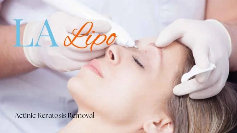 Woman receiving Actinic Keratosis Removal Treatment Binley