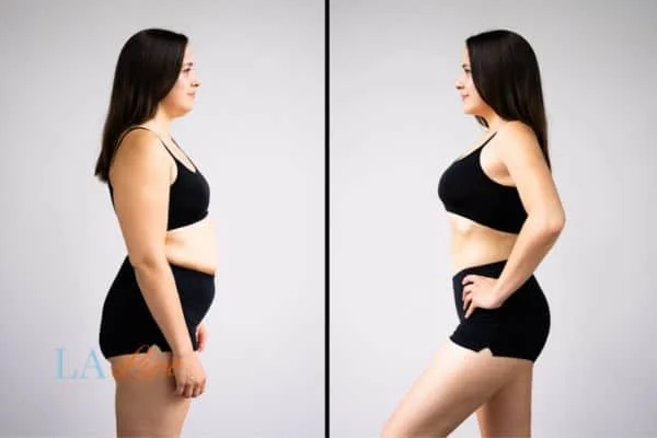 link between body image and mental health Binley