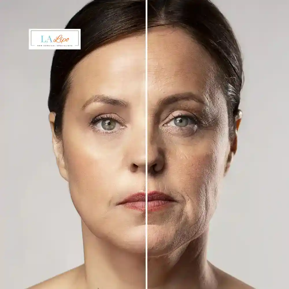 How Can You Tell If Non-Surgical Skin Tightening Is Right for You Binley?