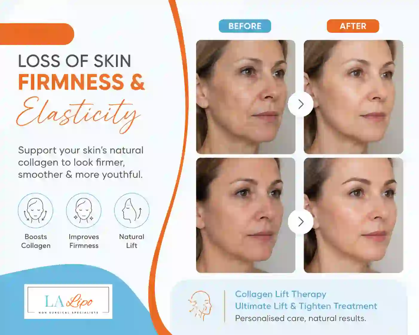 Sign #7: Loss of Skin Firmness and Elasticity Binley