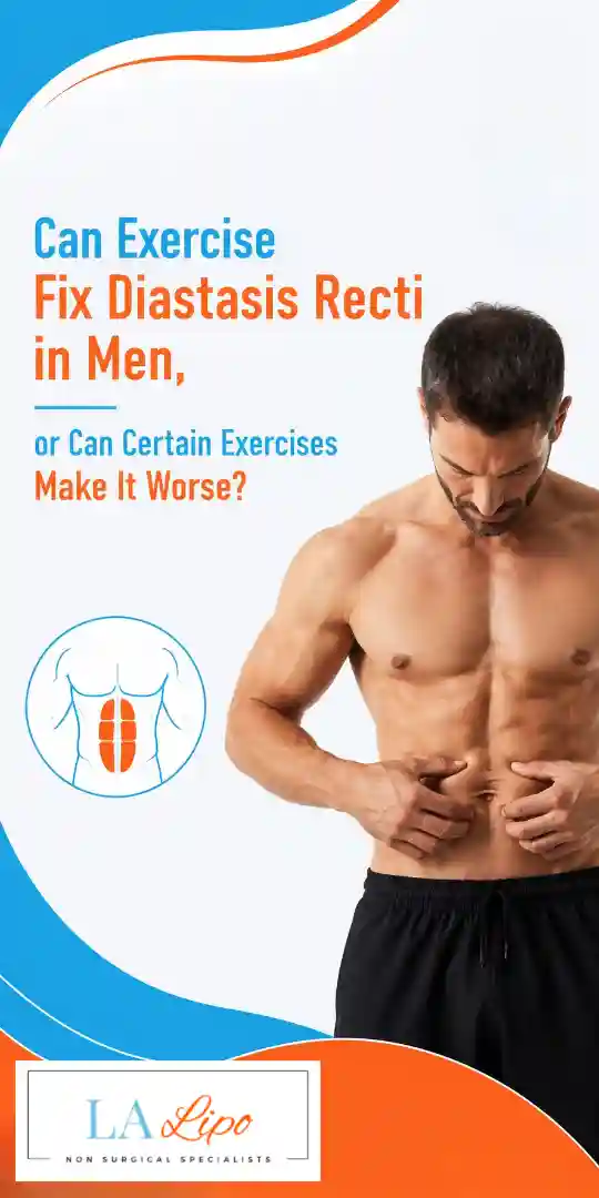 Can Exercise Fix Diastasis Recti in Men, or Can Certain Exercises Make It Worse Binley?