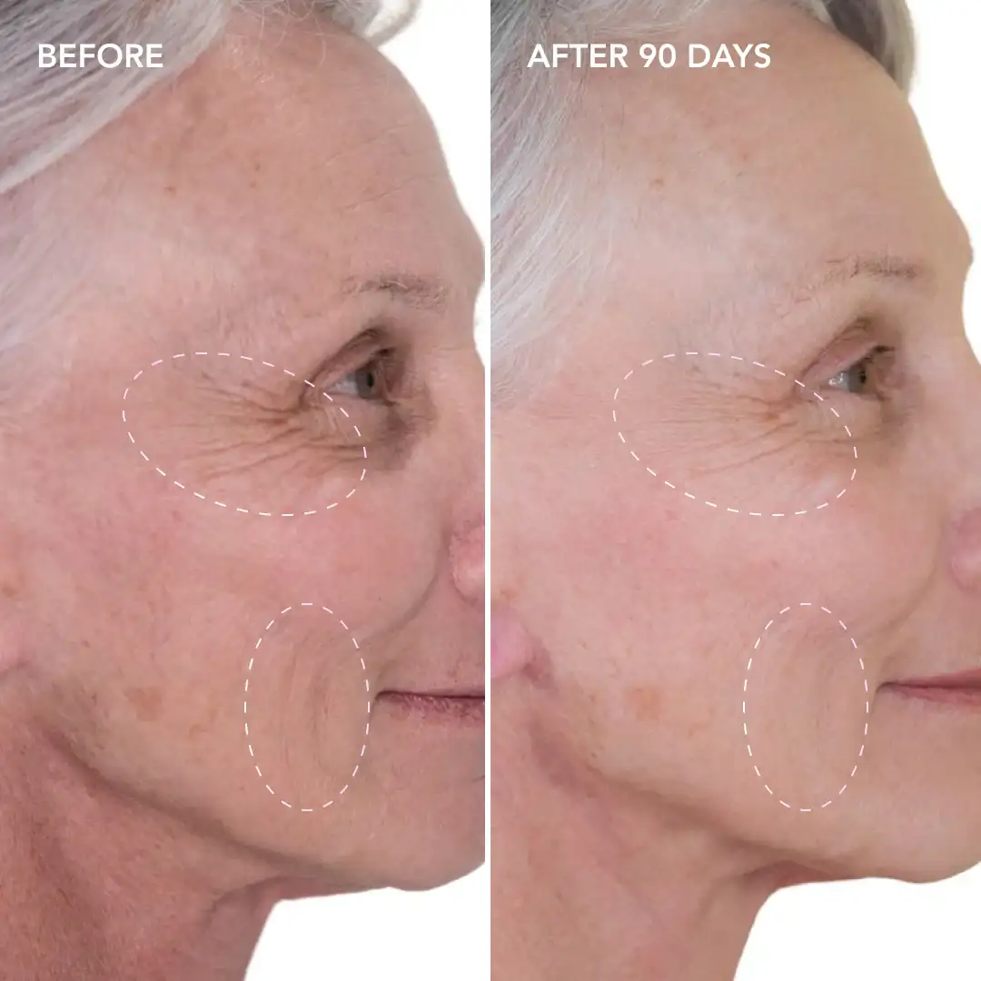 When will you see results Binley